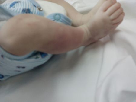 Bebê recém-nascido morre por asfixia na Vila Irmã Dulce