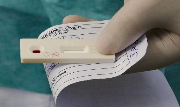 Brasil chega a 2 milhões de casos acumulados de covid-19