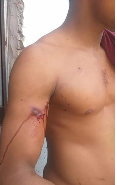 Homem é alvejado com três tiros no Conjunto Zé Pereira em Floriano