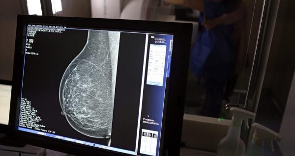 Outubro Rosa: Piauí realiza 57 mil mamografias e recebe 224 medicamentos para câncer de mama