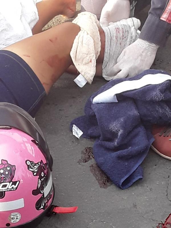 Acidente no Centro de Floriano, deixa mulher com fraturas expostas (Imagem:Reprodu&ccedil;&atilde;o)