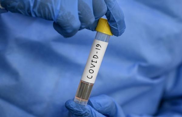 Número de casos de coronavírus no Piauí sobe 53% e estado tem mais de 134 mil infectados