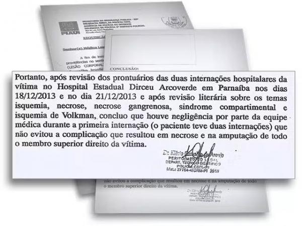 Laudo do IML conclui que houve neglig&ecirc;ncia m&eacute;dica com garoto amputado no PI.(Imagem:Reprodu&ccedil;&atilde;o)