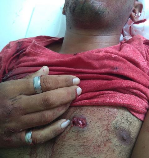 Homem de 23 anos é encontrado morto com cinco tiros