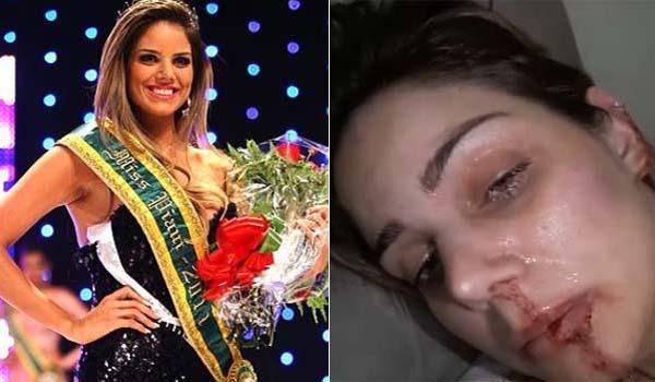 Ex-Miss Piau&iacute; fala pela 1&ordf; vez e faz desabafo: 
