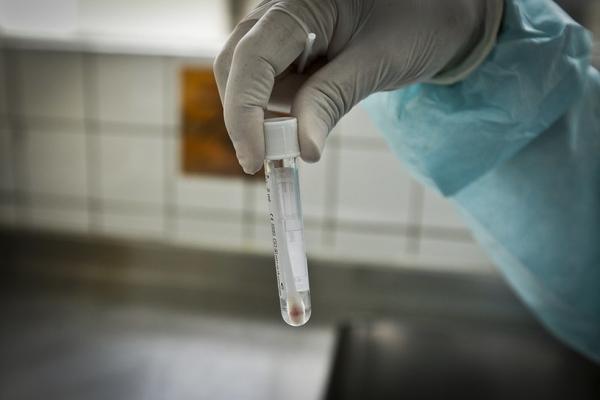 Piauí registra 203 casos confirmados e um óbito de Covid-19 nas últimas 24 horas