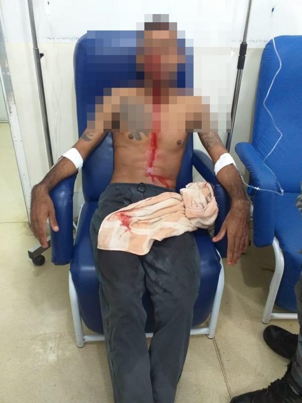 Acusado de assalto é baleado no rosto ao tentar roubar veículo de empresário
