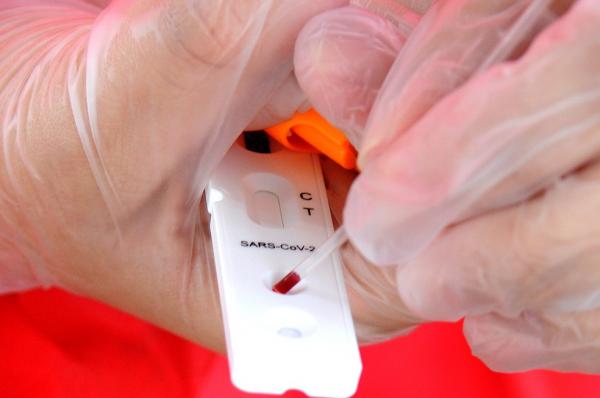 Os casos confirmados no estado somam 326.664 em todos os municípios piauienses. Já os óbitos pelo novo coronavírus chegam a 7.110 e foram registrados em 223 municípios. Dos leitos(Imagem:Reprodução)