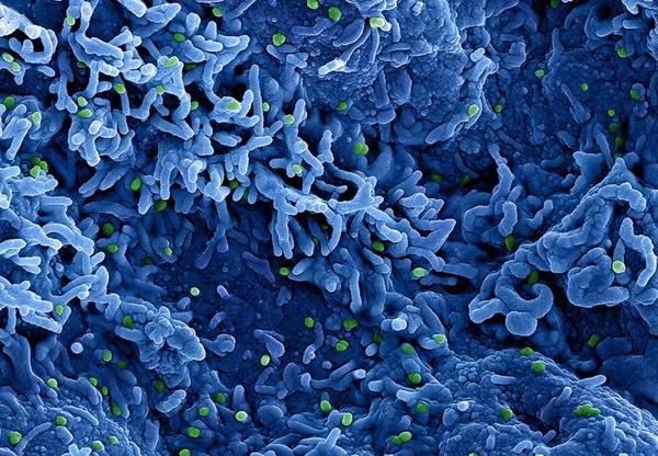 OMS estima custo de US$ 135 milhões em 6 meses para conter mpox