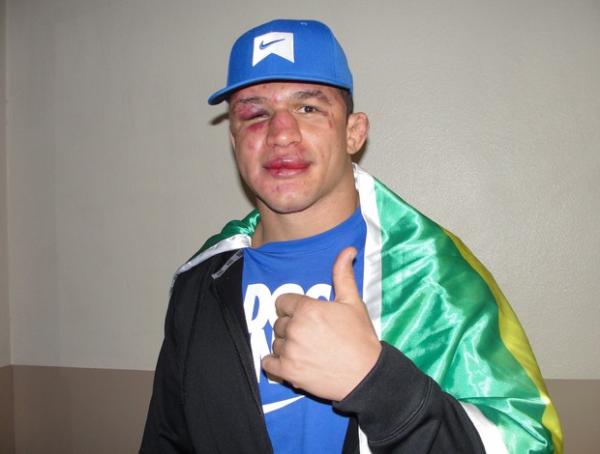 Cigano na sa&iacute;da do hospital, em Las Vegas, ap&oacute;s a derrota no UFC 155.(Imagem:Marcelo Russio / SporTV.com)
