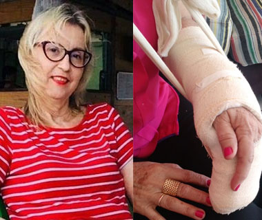 Em assalto, Laurenice França pula de carro em movimento e fratura mão