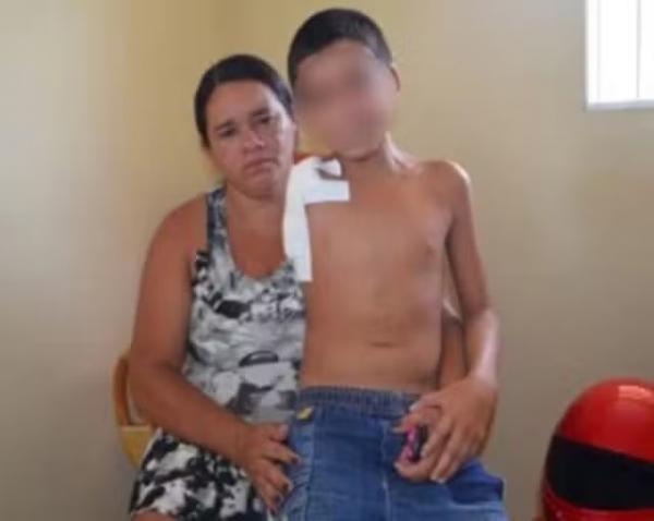 Garoto sofreu fratura exposta no bra&ccedil;o ap&oacute;s cair de cavalo no CE.(Imagem:Tacyane Machado)