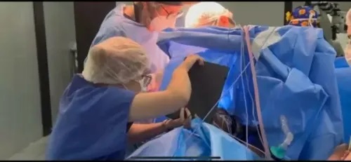 Pesquisadores da Uespi desenvolvem protocolo de avaliação neuropsicológica em neurocirurgias