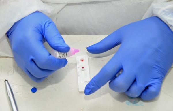 Piauí registra 515 novos casos de Covid-19 e 8 mortes pela doença em 24 horas
