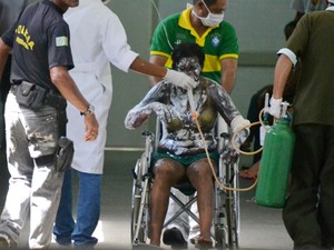 Morre detenta grávida queimada após 10 dias na UTI em Parnaíba
