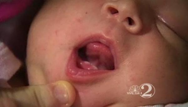 Beb&ecirc; nasceu com dois dentes em Plant City. (Imagem:Reprodu&ccedil;&atilde;o/Wesh)