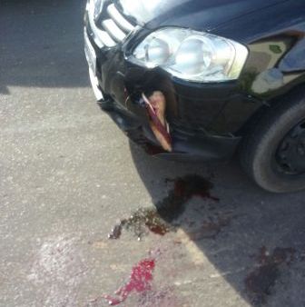 Jovem tem pé amputado em acidente em Barão de Grajaú