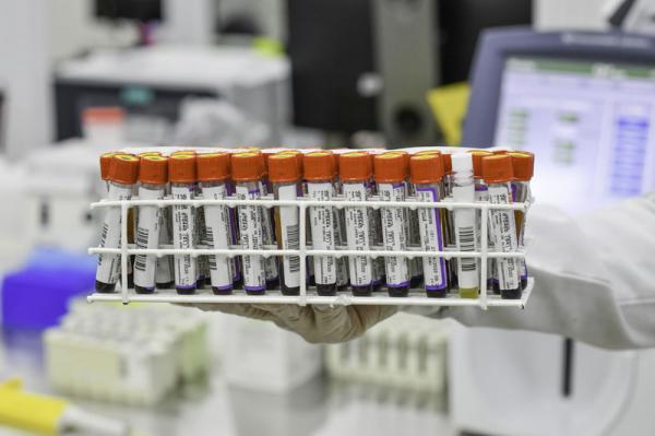 Tubos de laboratório(Imagem:Reprodução)