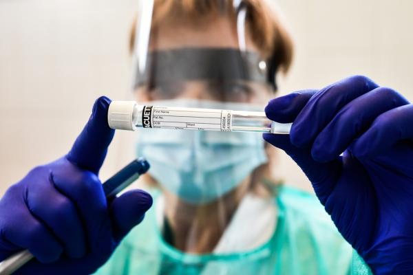 Piauí chega a 3550 casos e 110 mortes pela Covid-19