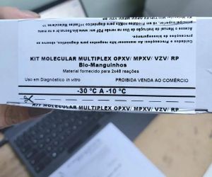 Lacen passará a realizar exames para detectar mpox no Piauí