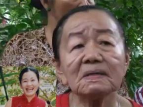 Reação alérgica fez vietnamita de 26 anos ficar com aparência de 70