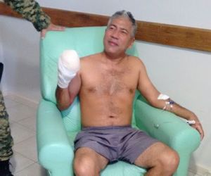 PM ferido após explosão de bomba poderá ter dedos reimplantados
