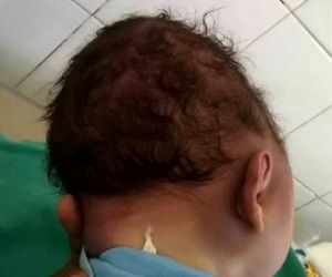 Polícia vai exumar o corpo da criança que morreu no Hospital Tibério Nunes