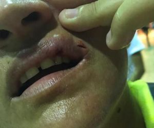 Árbitra é agredida a socos ao expulsar estudante de torneio em universidade