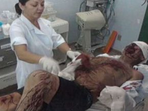 Idoso de 72 anos tem o braço decepado após sacar dinheiro