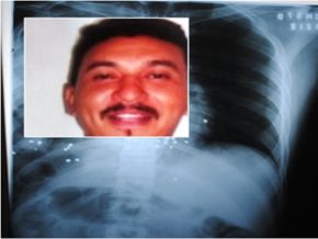 Homem é assassinado com um tiro de espingarda na axila