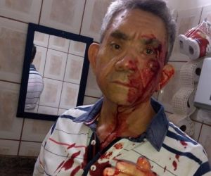 Professor é agredido a socos por aluno de 14 anos e relata medo