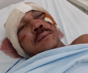Pedreiro sofre tentativa de homicídio e é atingido com várias facadas em Floriano