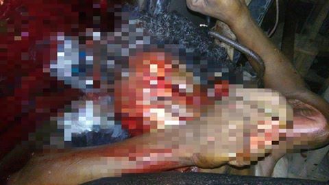Homem tem corpo dilacerado ao ser atropelado por carreta no interior do PI