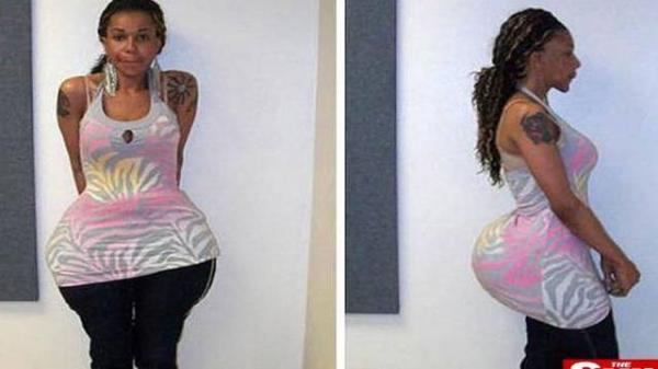O falso m&eacute;dico tem apar&ecirc;ncia de mulher e aumentou o pr&oacute;prio bumbum.(Imagem:Reprodu&ccedil;&atilde;o)