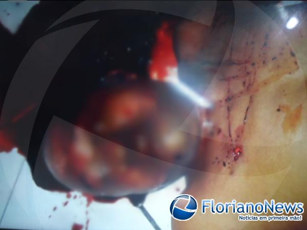 Dono de bar é morto a tiros e facadas em Floriano