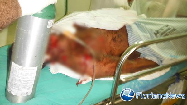 PM registrou tentativa de homic&iacute;dio passional em Floriano(Imagem:FlorianoNews)
