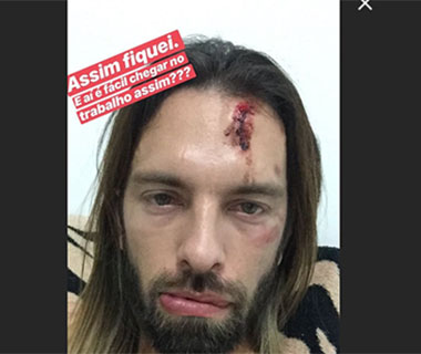 Cliente denuncia agressão em casa noturna de Teresina
